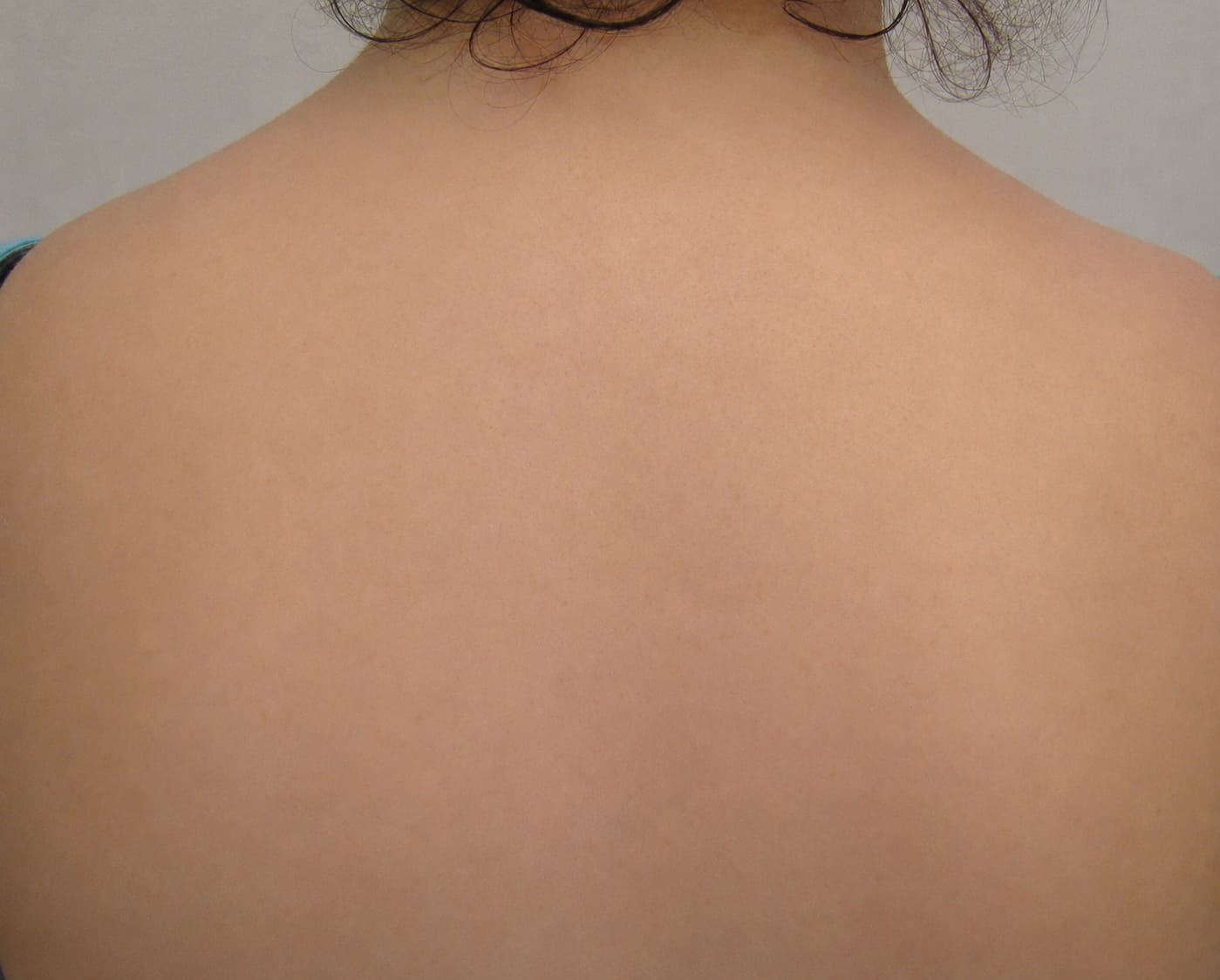 The same back with clear skin
